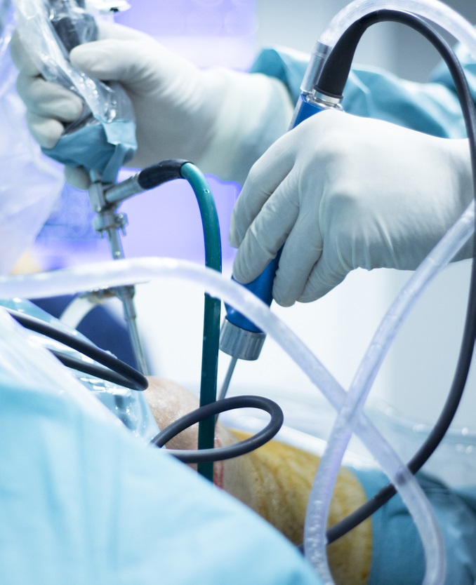 Hospital con servicios de artroscopia